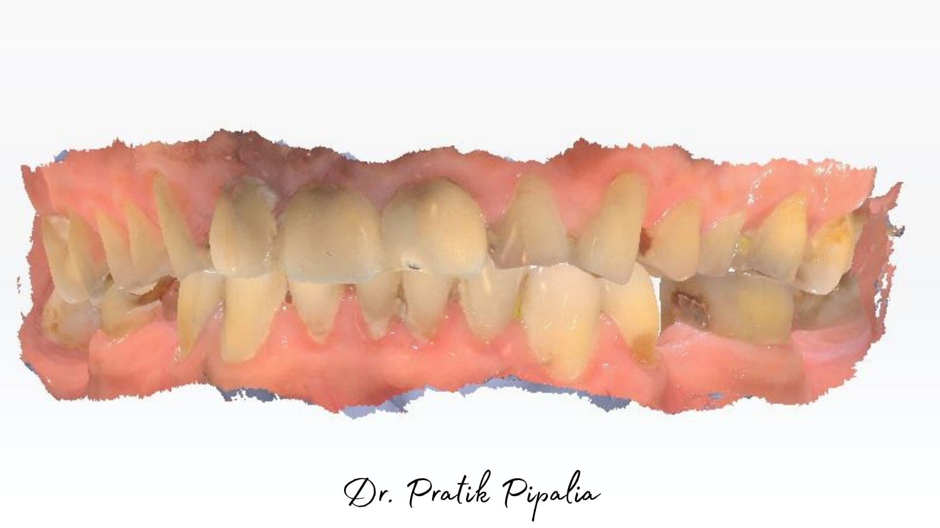 Before treatment